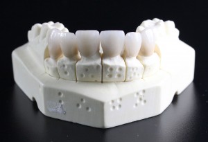 tooth-replacement-759929_1280
